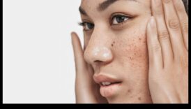 Ādas kopšana un stress: ārējo faktoru pārvaldība mierīgai sejas ādai