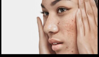 Ādas kopšana un stress: ārējo faktoru pārvaldība mierīgai sejas ādai